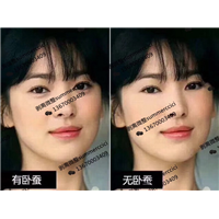 博恩汇美剥离美学