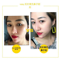 vsey无针轻医美项目 