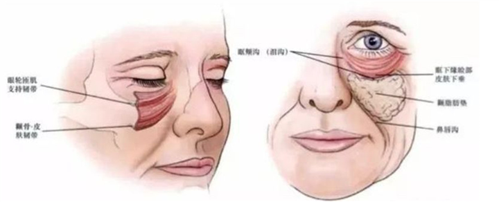 深度分析印第安纹形成原因，5大印第安纹去除方法的缺点你知道吗