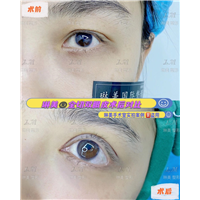 上海琳美眼综合整形