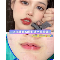 上海琳美M唇整形
