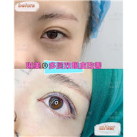 上海琳美眼综合整形