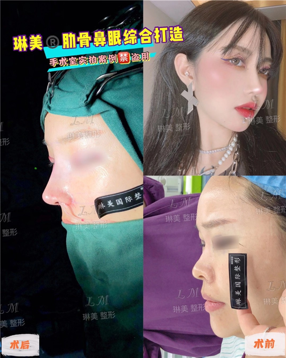 上海琳美鼻综合整形