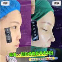 上海琳美鼻综合整形