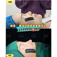 上海琳美鼻综合整形