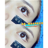 上海琳美眼综合整形