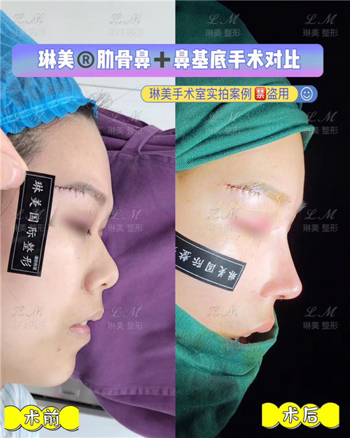 上海琳美鼻综合整形
