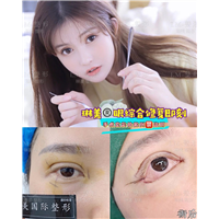 上海琳美眼综合整形