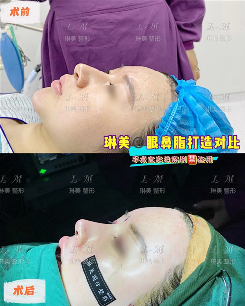 上海琳美鼻综合整形