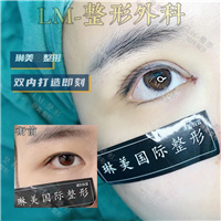 上海琳美眼综合整形