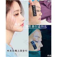 上海琳美鼻综合整形