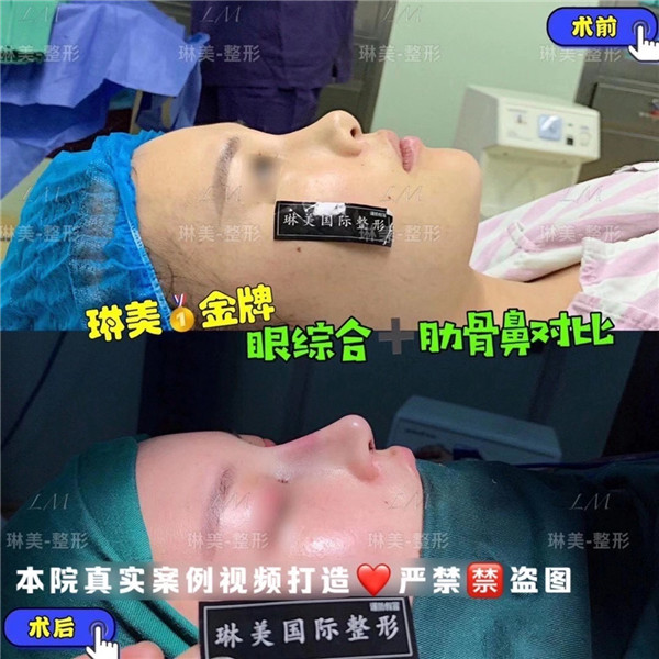 上海琳美鼻整形