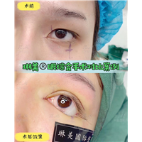上海琳美眼综合整形
