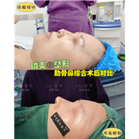 上海琳美鼻综合整形 