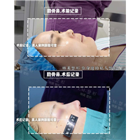 上海琳美鼻综合整形
