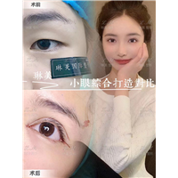 上海琳美眼综合整形