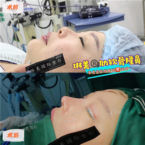 上海琳美鼻综合整形