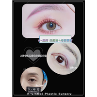 琳美整形眼综合整形 