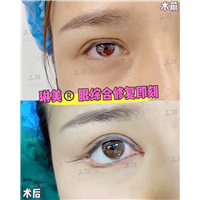 上海琳美眼综合整形