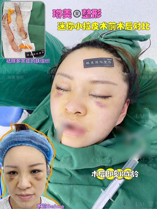 上海琳美整形 