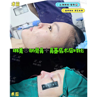 上海琳美鼻综合整形