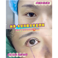 上海琳美眼综合整形