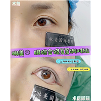 上海琳美眼综合整形
