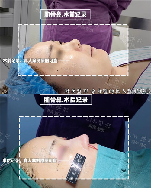 上海琳美鼻综合整形