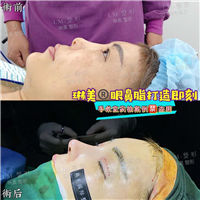 上海琳美鼻综合整形