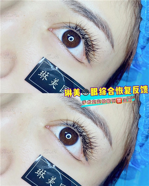上海琳美眼综合整形