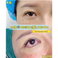 上海琳美眼综合整形