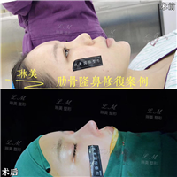 上海琳美鼻综合整形