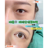 上海琳美眼综合整形