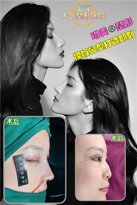 上海琳美鼻综合整形