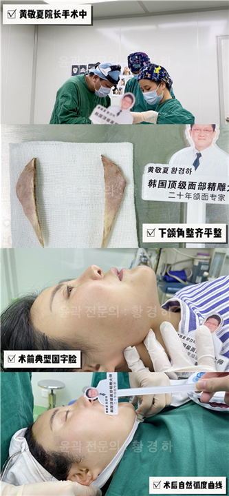 琳美磨骨整形