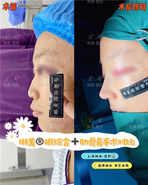 上海琳美鼻综合整形