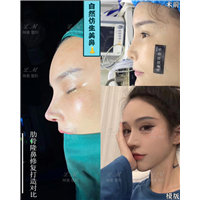 上海琳美鼻综合整形