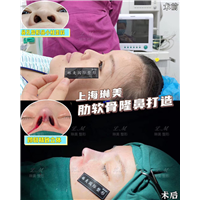 上海琳美鼻综合整形