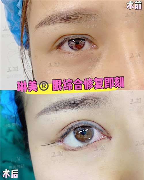 上海琳美眼综合整形