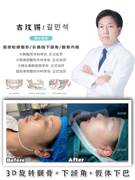 琳美磨骨整形