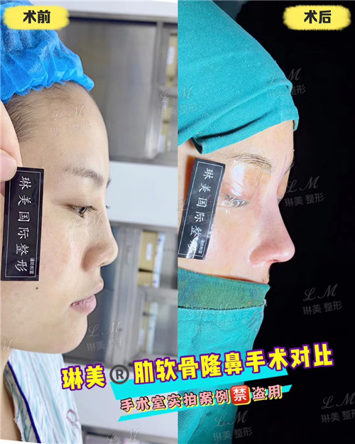 上海琳美鼻综合整形