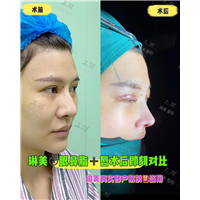 上海琳美鼻综合整形