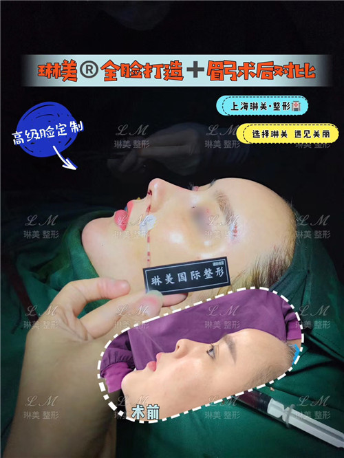 上海琳美鼻综合整形
