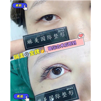 上海琳美眼综合整形