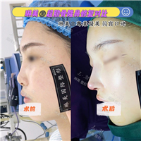 上海琳美鼻综合整形