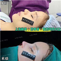 上海琳美鼻综合整形