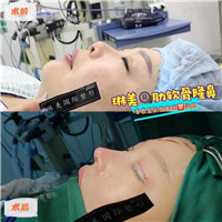 上海琳美鼻综合整形