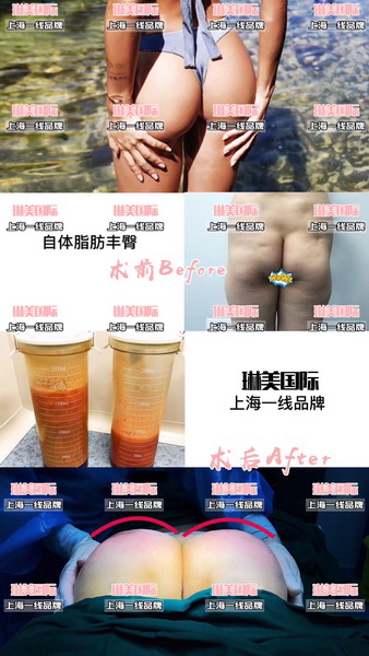 上海抖音**姐整形医院