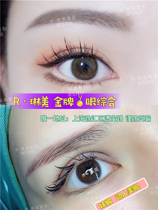 上海琳美眼综合整形