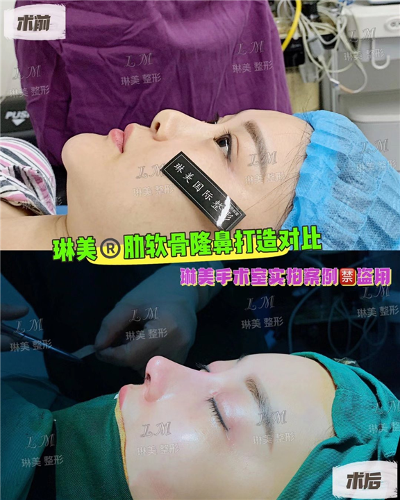 上海琳美鼻综合整形